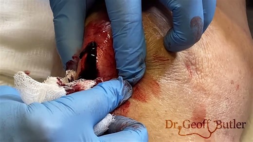Effective Drainage of Knee Hematoma: A Comprehensive Guide for Faster Recovery