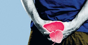 Quando é necessária uma biópsia de próstata? | Coisas de Homens