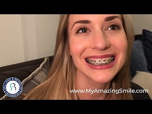 Orthodontic Consultation Photos at Home - Braces - Invisalign - Spillane & Reynolds Orthodontics