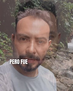 Hair Center - Clínica de Cirugía Capilar on Reels