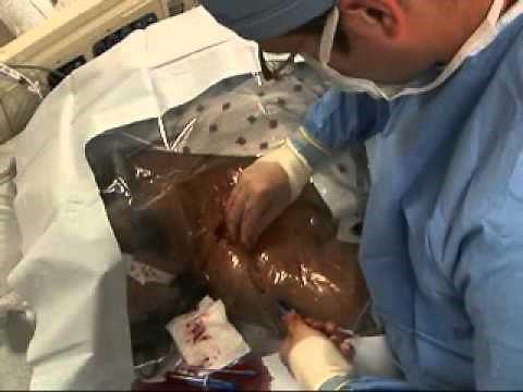 NEJM Central Venous Line Placement