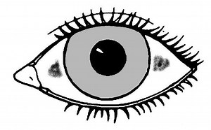 Bitot's spots - Alchetron, The Free Social Encyclopedia