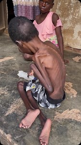 He is Ibrahim , He is severely malnourished whichded to stunted growth and severe muscle wasting, 5 years now he became so slim, he can’t move, eat or do anything by herself. We need to take her for treatment, wheelchair, food and clothes. please support KISAKYE. LINK BIO TO DONATE | Baker Nalugoda