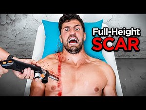 Creating The World's Longest Scar For Science!