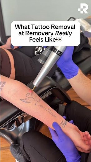 What tattoo removal really feels like...👀 #removery