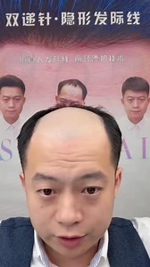 266K views · 1.8K reactions | Whtsapp:+923424080700 `#Wigs` `#WigLove` . `#WigStyle` `#WigInspiration` `#WigHaul `#WigLife` `#WigCommunity` `#EuropeanWigLovers` `#USAWigFashion` `#WigFashion` . `#HairFashion` `#StyleInspiration` `#BeautyTrends`#WigTrends` `#FashionWigs` `#WigObsessed` `#WigLoversUnite` `#VirtualTryOnWigs` | Uk Wigcenter | Facebook