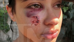Rich The Kid's Girlfriend Recounts Home Invasion Assault [VIDEO]