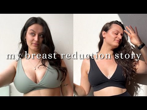 my breast reduction story (with dr lyndsey highton)