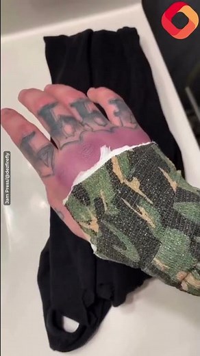 Extreme body modification TikToker spends $10,000 on transformation including PENTAGRAM implanted