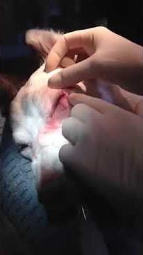 Eyelid Mass Removal Part 5 of 5