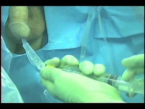 Greenlight XPS -STANDARDIZED CASE COMPLETION VIDEO.mov