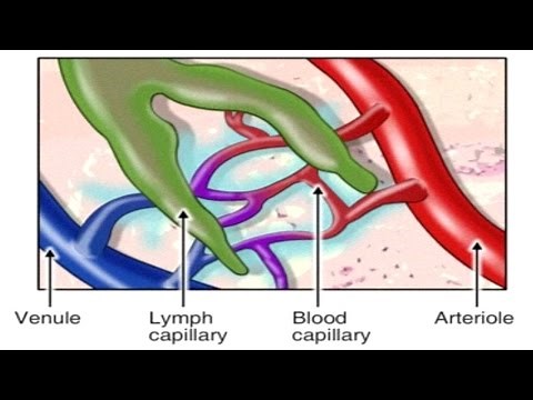 How Lymphatic System Works Animation: Spreading of Breast Cancer - Pathophysiology of Edema Video