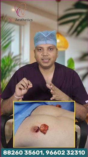 Puffy Nipples Treatment in Jaipur | Permanent Solution | Dr Vikas Gupta