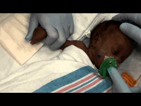 Neonatal Venous Blood Sampling