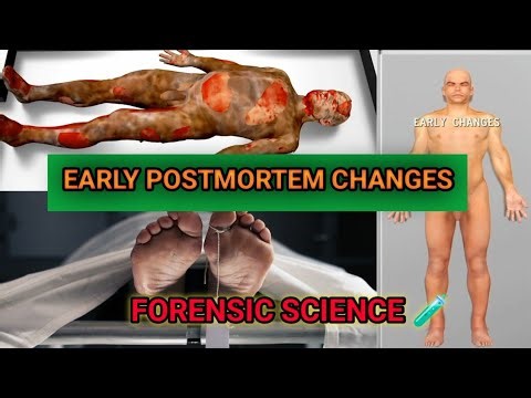 EARLY POSTMORTEM CHANGES | FORENSIC SCIENCE 🧪 | Medical Team | Medical Students #forensicscience
