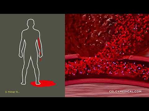 CELOX Rapid & CELOX Gauze Mode of Action Video