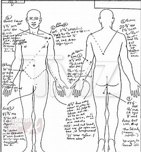 Biggie Smalls Autopsy Photos
