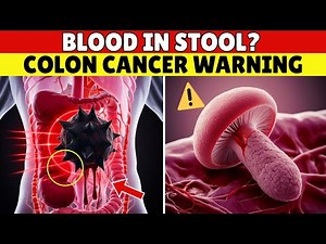 Blood in the Toilet? Why You Should NEVER Assume It’s Just Hemorrhoids