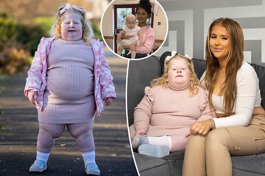 My 5-year-old weighs 100 lbs. and can’t stop eating