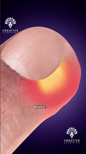 Stop Peeling Hangnails! 😲 #shorts #youtubeshorts - creativelearning3d