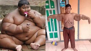 Arya Permana: La impresionante transformación del 'niño más obeso del mundo'