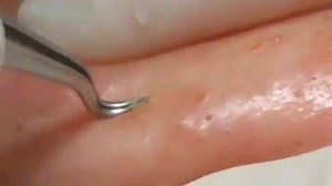 Uma espinha fantasiada de bicho da goiaba srsr 😂🎃👻 | Estetica da Depressão