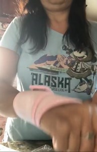 2PCS Version Profession Wrist Support, Adjustable Strap Reversible Wrist Brace for Sports Protecting/Tendonitis Pain Relief/Carpal Tunnel/Arthritis/Injury Recovery, Right&Left