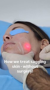 Lost the weight, but not the loose skin? Endolift is a non-surgical solution to treat skin laxity on the face and body, with minimal downtime and long-term results. Book your FREE consultation now 📩 | Pulse Light Clinic