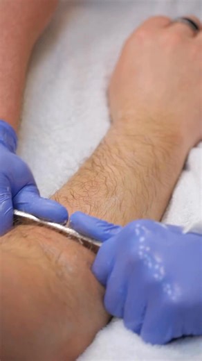 Soft tissue mobilization is a hands-on technique used in physical therapy to target tight or restricted muscles and fascia.Whether done manually or with tools like IASTM (scrapers), it helps break down scar tissue, release adhesions, reduce muscle tension, and improve circulation.This improves range of motion, decreases pain, and prepares the body for effective movement and strengthening.It’s often used in combination with stretching, exercise, or joint mobilization for best results. #physicalth