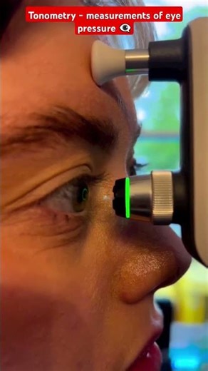 Tonometry measurements of eye pressure #tonometry #ophthalmology #ophthalkripa #iop #ophthalmologist
