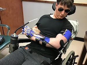 Bilateral Dynamic Saebo Hand Splints
