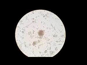 Toxocara cati egg under the microscope, from a kitten stool