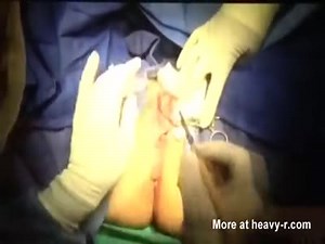 Female Circumcision, Labiaplasty