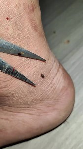 Amazing Play trick with mosquito #mosquito #mosquitoes #mosquitobites #mosquitorepellent #mosquitokiller #mosquitos #mosquitocontrol #culicidae #dengue #culicidae_mosquito #aedesaegypti #freedeet #repellent #chikungunya #malaria #endmalaria #mosquitobite #zika #aedes #antimosquito #mosquitoseason #insectrepellent #mosquitofree #controledepragas #worldmalariaday #entomologylove #naturalmosquitotreatments #desinsetiza #limpezadecaixadagua #diptera | Lexus Pet Boutique