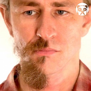 16K views · 70 reactions | Watch the wound healing timelapse and more Partner: Kolo / Time Lapse YT: https://www.youtube.com/@KoloTimeLapse/videos | Creative Panda | Facebook