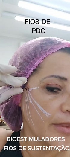 #VozDoMalvadao #harmonizacao facil##beleza#anita#foryou #vaibrasil #viral #remoçãodecravos #shuffledance #fy #fypシ