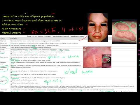 89P Systemic lupus erythematosus, SLE, how to diagnosis, Etiology and Pathogenesis