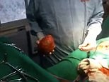 Gruesome moment surgeons 'crow-bar' huge stone from man's bladder