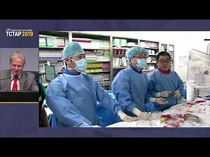 [TCTAP 2019] Master the CTO - Live Case Session II