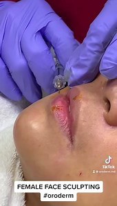  WHAT IS FACE SCULPTING? ✅ Our signature treatment ✅ Non-surgical...