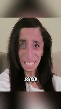 These are the rarest genetic diseases in the world — the last one is unbelievable 😨