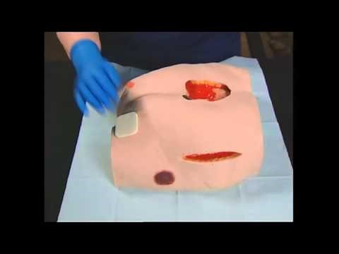 Foam Wound Dressings | Absorbent Wound Dressings | Primary Wound Dressings
