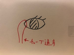 涙道手術（1）…人間のお話です。