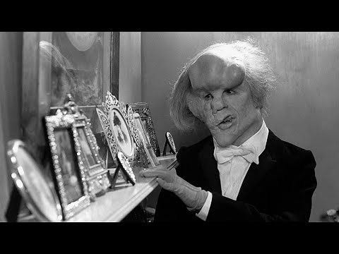 The TERRIFIC History of Proteus Syndrome