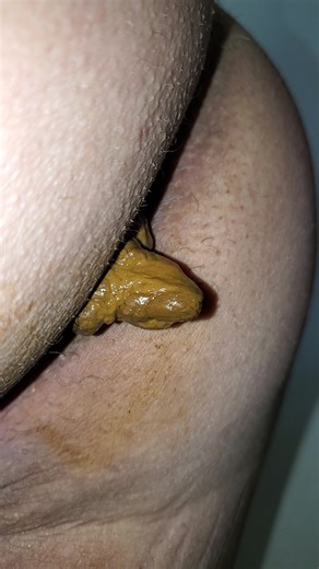 Pooping 87 - Right After Trampoline 2