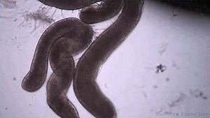 This close-up of a jellyfish tentacle shows its stinger mechanism in action. When a small voltage is applied to the tentacle under the microscope, it triggers the firing of cnidocytes (nematocytes). A cnidocyte is an explosive cell containing one large secretory organelle filled with venom and a long hollow tubule. Upon firing, the hollow tubule is pushed outwards and penetrates into the prey/predator, where it delivers its toxic payload. | GizmoCrazed | Facebook