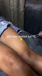 Smooth, flawless skin starts here. Experience effective scar removal treatments at Bella Callista Beauty Lounge Bella Callista Beauty Lounge ✨💞 | MOMMY BELLA