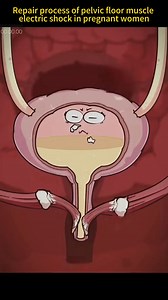 #pregnant #women #pelvic #floor #muscle #electric #shock #repair #foryou #fypシ #sciencefacts #mathematics#physics#life #subject #science #quantumphysics, #fyp #foryou #tiktok #lnteresting#science#physics | Sience