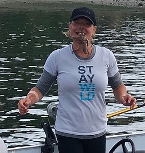 This Woman Put an Octopus on Her Face—And Wound up In the Hospital After It Bit Her