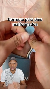 80K views · 359 reactions | #fypシ゚ #vdeoviralシ #lubperfecto #reelsviralシ #videoreelsシ #fypviralシ #corrección #juanetes #facebookviral #tendecias2025 | Matias Matute Mosquera | Facebook